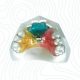 orthodontic 3way expander appliance