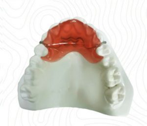 orthodontic bite plate