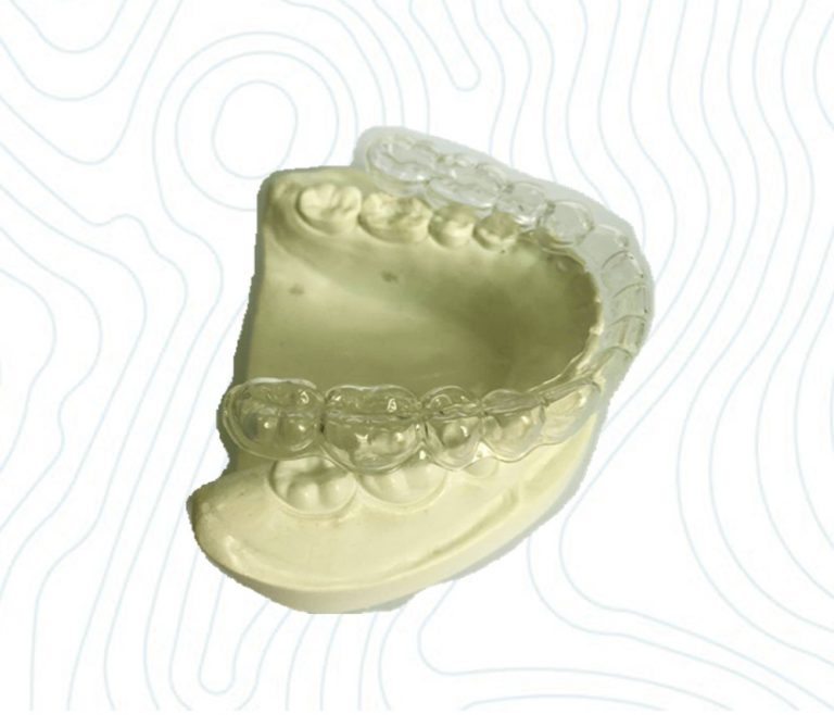 dentalbleachingtray China Orthodontic