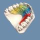 high quality orthodontic appliance