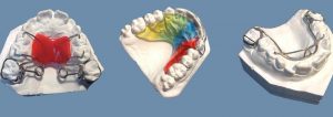 high quality orthodontic appliance