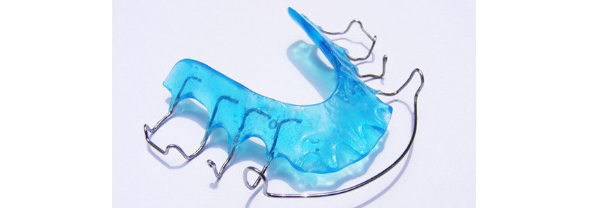 mobile orthodontic appliances