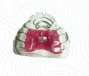 orthodontic appliance