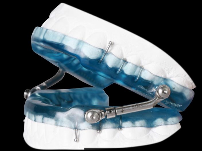 sleepherbstappliance China Orthodontic